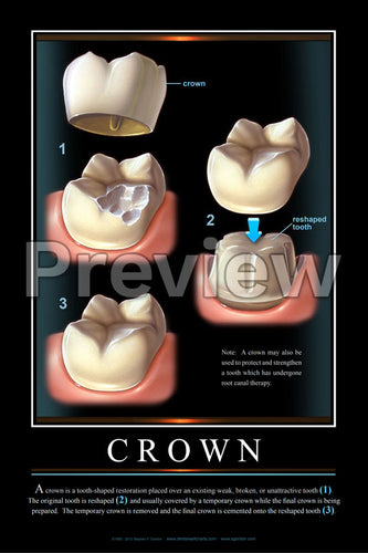 Crown Wall Chart