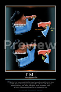 TMJ Wall Chart