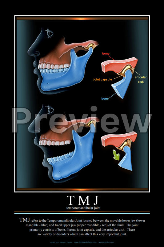 TMJ Wall Chart