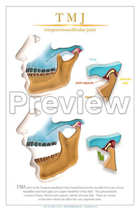 TMJ Wall Chart