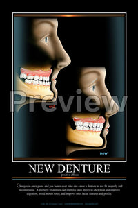 New Denture Wall Chart