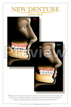 Load image into Gallery viewer, New Denture Wall Chart