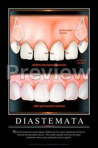 Diastemata Wall Chart