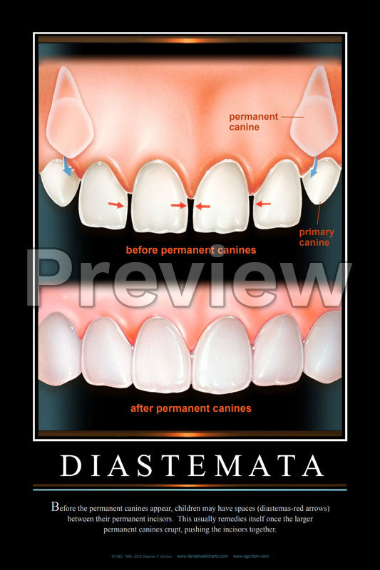 Diastemata Wall Chart