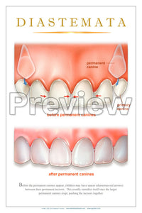 Diastemata Wall Chart