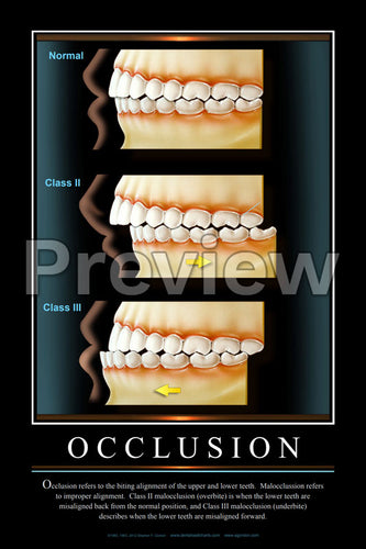 Occlusion Wall Chart