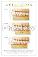 Load image into Gallery viewer, Occlusion Wall Chart