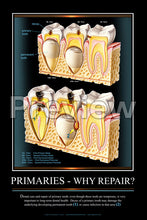 Load image into Gallery viewer, Primaries - Why Repair? Wall Chart