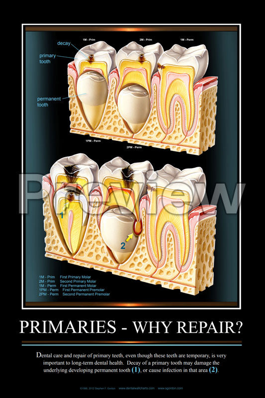 Primaries - Why Repair? Wall Chart