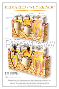 Primaries - Why Repair? Wall Chart