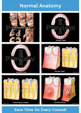Load image into Gallery viewer, Dental-Patient Consultation Illustrations