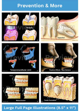 Load image into Gallery viewer, Dental-Patient Consultation Illustrations